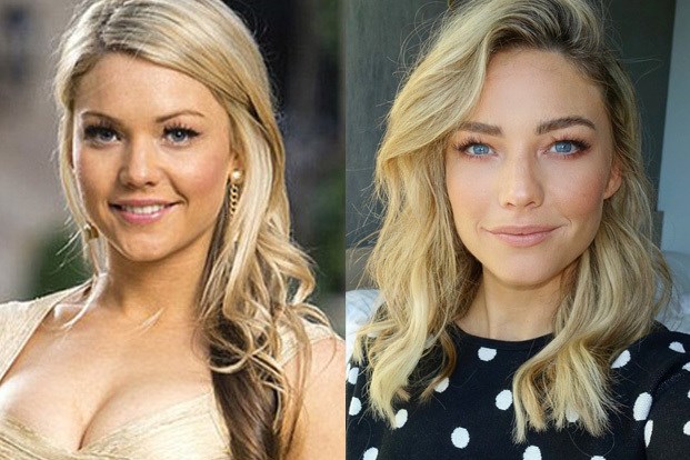 Sam Frost Before And After