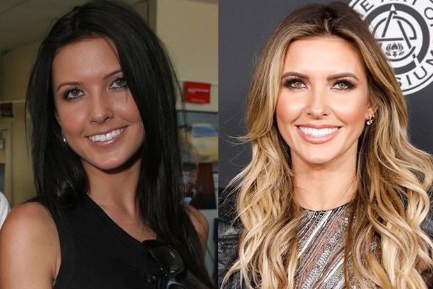 The Hills' Cast Transformations: See The Stars Then & Now